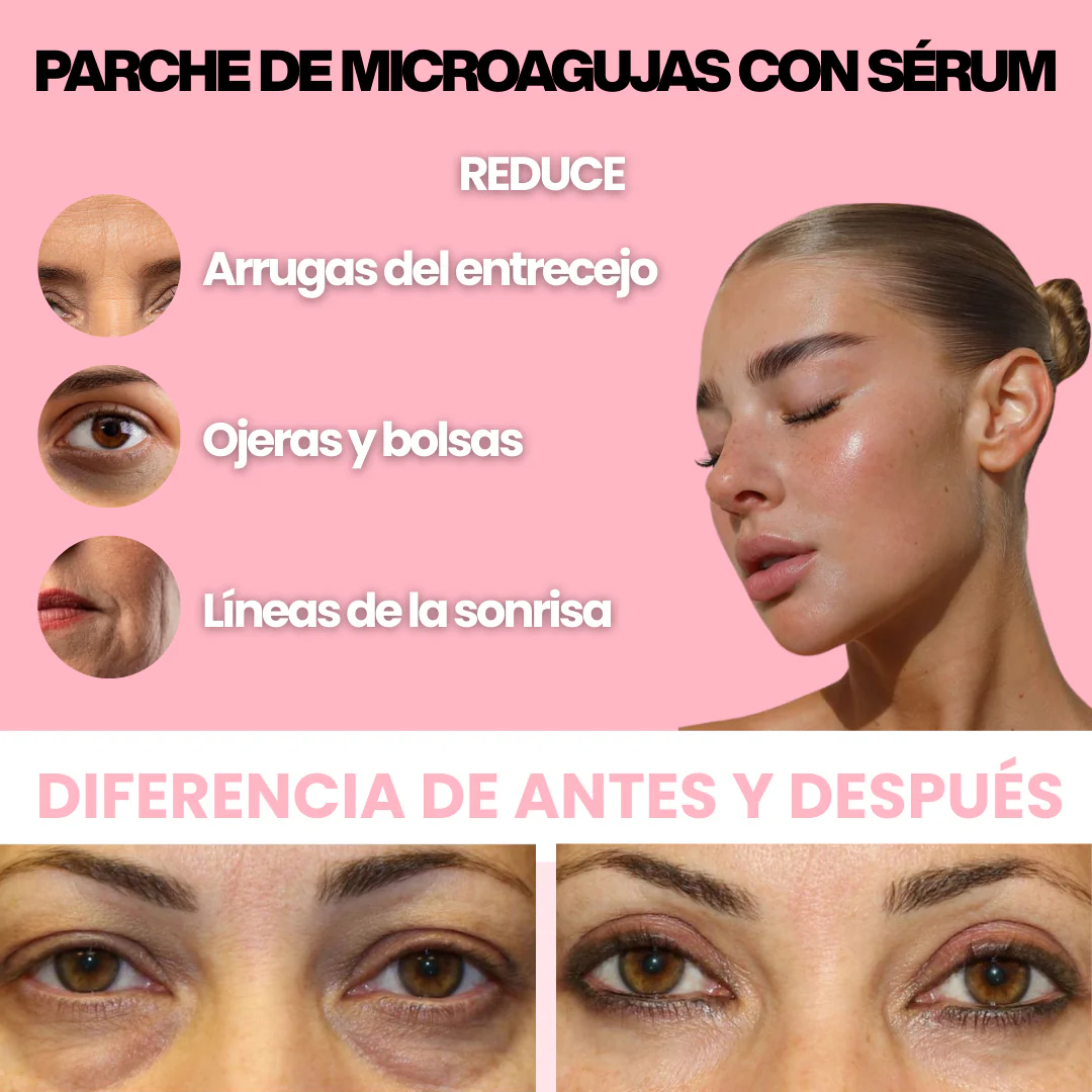 Tratamiento para bolsas y ojeras