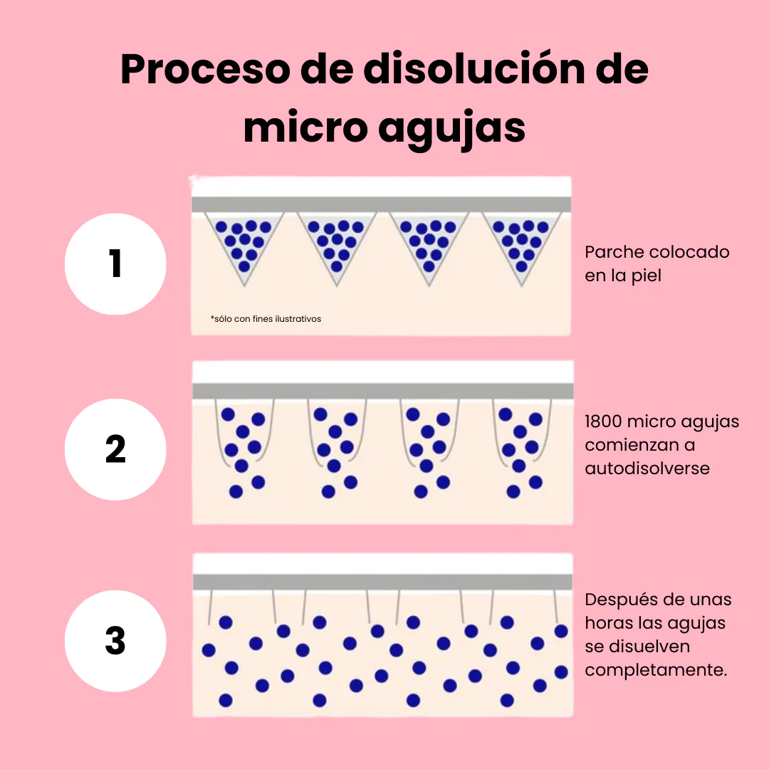 Tratamiento para bolsas y ojeras