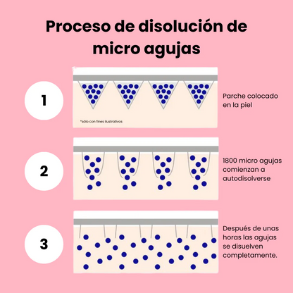 Tratamiento para bolsas y ojeras