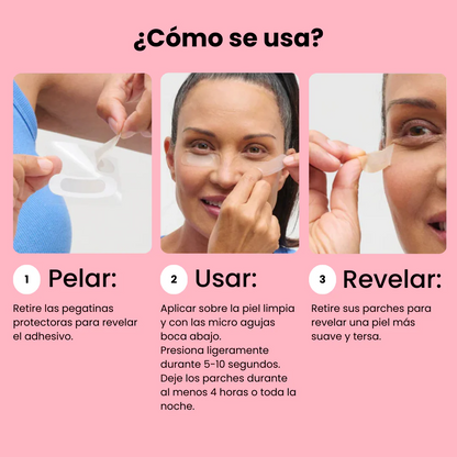 Tratamiento para bolsas y ojeras