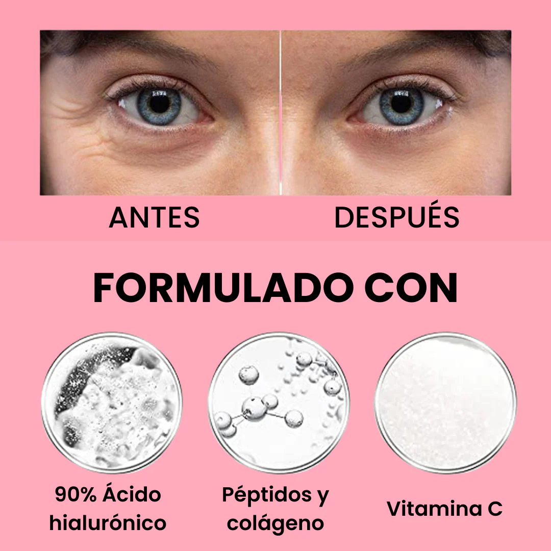 Tratamiento para bolsas y ojeras